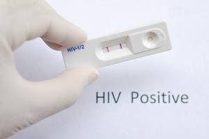 Sinh phẩm xét nghiệm HIV qua phát hiện kháng thể ngày càng chính xác hơn