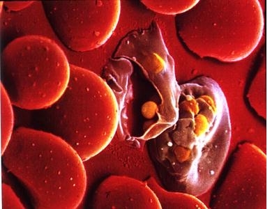 Sự ức chế ứng động hóa học đối với bạch cầu đơn nhân và đa nhân trung tính của máu trong sốt rét cấp tính ở người