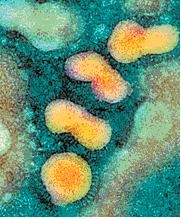 H5N1: Công trình nghiên cứu về sự lây truyền bệnh cúm là khẩn cấp
