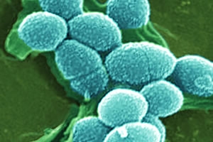 Nhiễm khuẩn máu do Enterococcus spp. gây ra liên quan đến ống thông