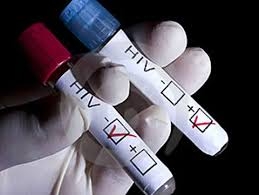 CANADA TIẾN TỚI XÉT NGHIỆM HIV THƯỜNG QUY