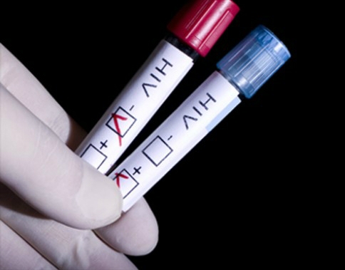 Xét nghiệm HIV bằng thiết bị vi xử lý